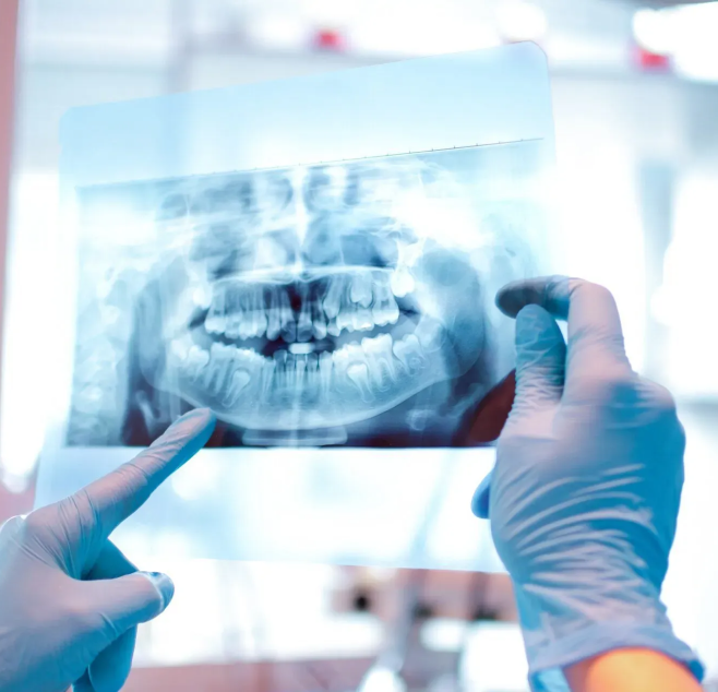 Bretagne Service Dentaire Materiel Dentaire Rennes Materiel D Imagerie Dentaire En 2D Et En 3D Intra Oral Extra Oral Camera Bretagne Service Dentaire Materiel Dentaire Rennes Materiel D Imagerie Dentaire En 2D Et En 3D Intra Oral Extra Oral Camera