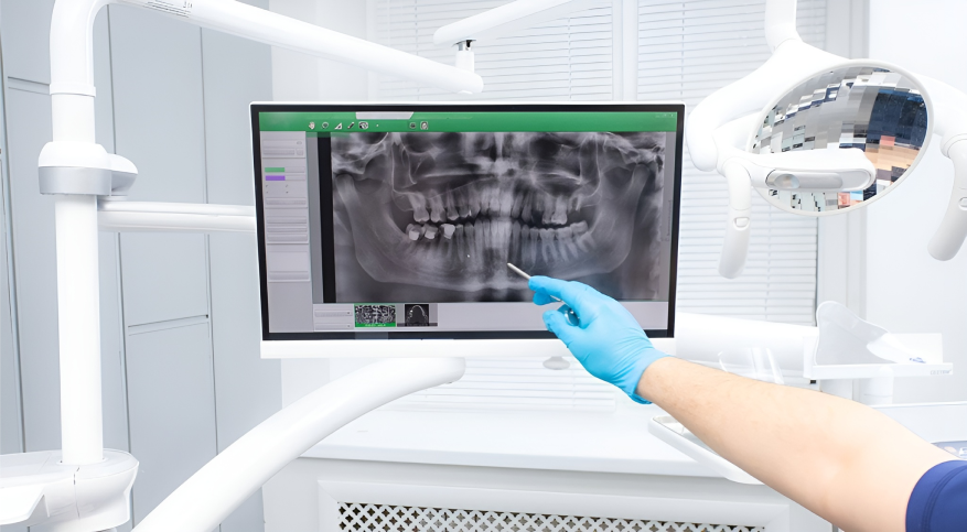 Bretagne Service Dentaire Materiel Dentaire Rennes Vente Et Installation De Systemes De Radiologie Imagerie Scanner Dentaire 1 Bretagne Service Dentaire Materiel Dentaire Rennes Vente Et Installation De Systemes De Radiologie Imagerie Scanner Dentaire 1