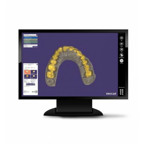 Bretagne Service Dentaire Materiel Dentaire Rennes Exocad Software 2058